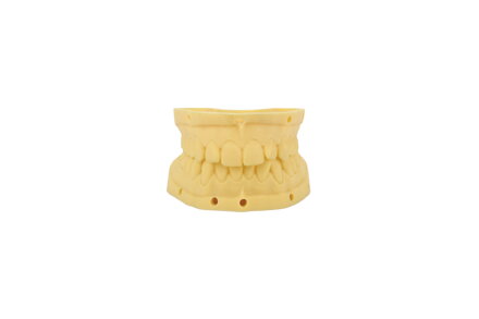 DENTAL model resin - živica pre zubné modelovanie eSUN 1 kg